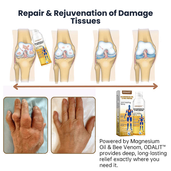 đFlash Sale - ODALIT⢠Magnesium Oil & Bee Venom Joint Healing Sprayđđ