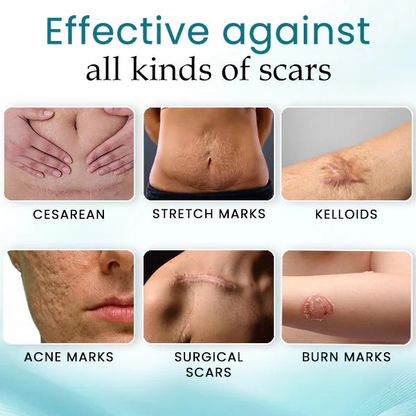 NEGUSY™ Advanced Scar Treatment Solution