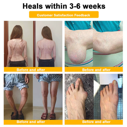 🎁Flash Sale - ODALIT™ Botulinum Toxin & Bee Venom Pain-Relief Bone Healing Cream🐝💎