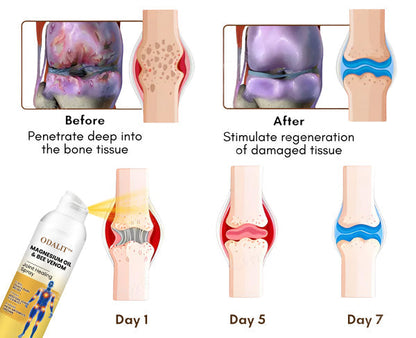 🎁Flash Sale - ODALIT™ Magnesium Oil & Bee Venom Joint Healing Spray🐝💎