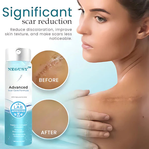 NEGUSY™ Advanced Scar Treatment Solution
