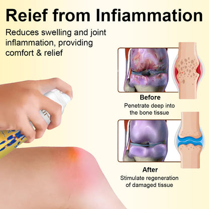 🎁Flash Sale - ODALIT™ Magnesium Oil & Bee Venom Joint Healing Spray🐝💎