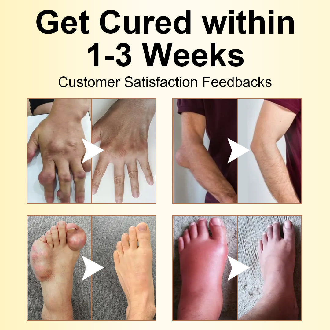 🎁Flash Sale - ODALIT™ Magnesium Oil & Bee Venom Joint Healing Spray🐝💎