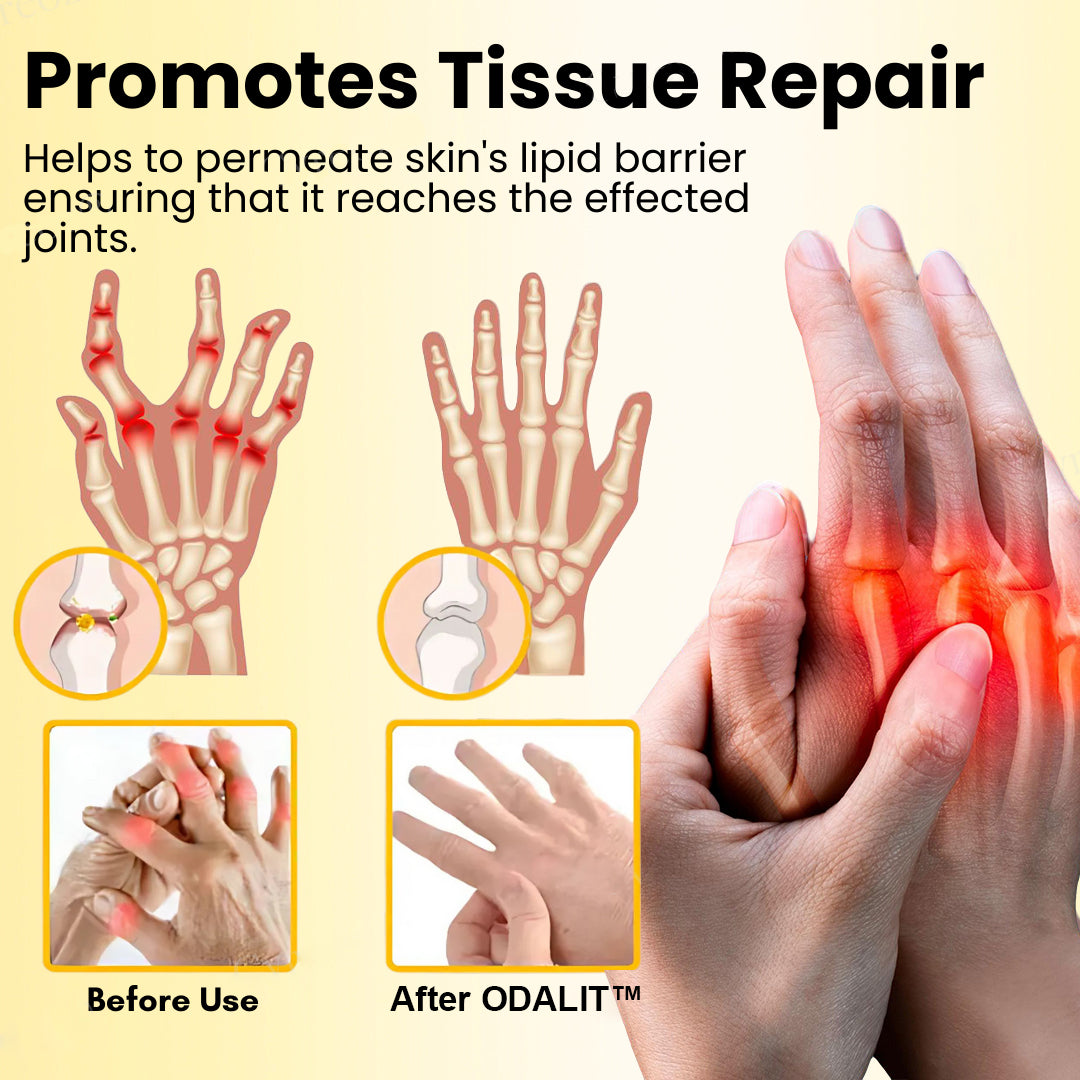 🎁Flash Sale - ODALIT™ Magnesium Oil & Bee Venom Joint Healing Spray🐝💎