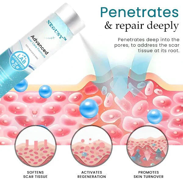NEGUSY™ Advanced Scar Treatment Solution