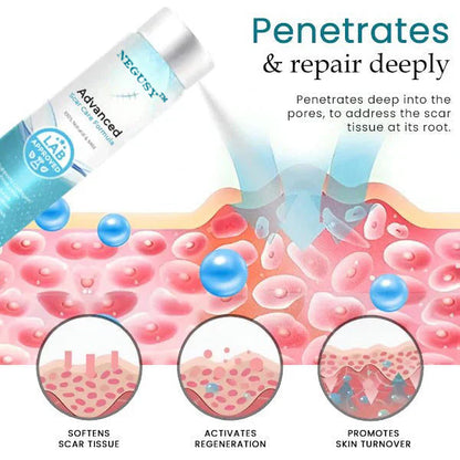 NEGUSY™ Advanced Scar Treatment Solution