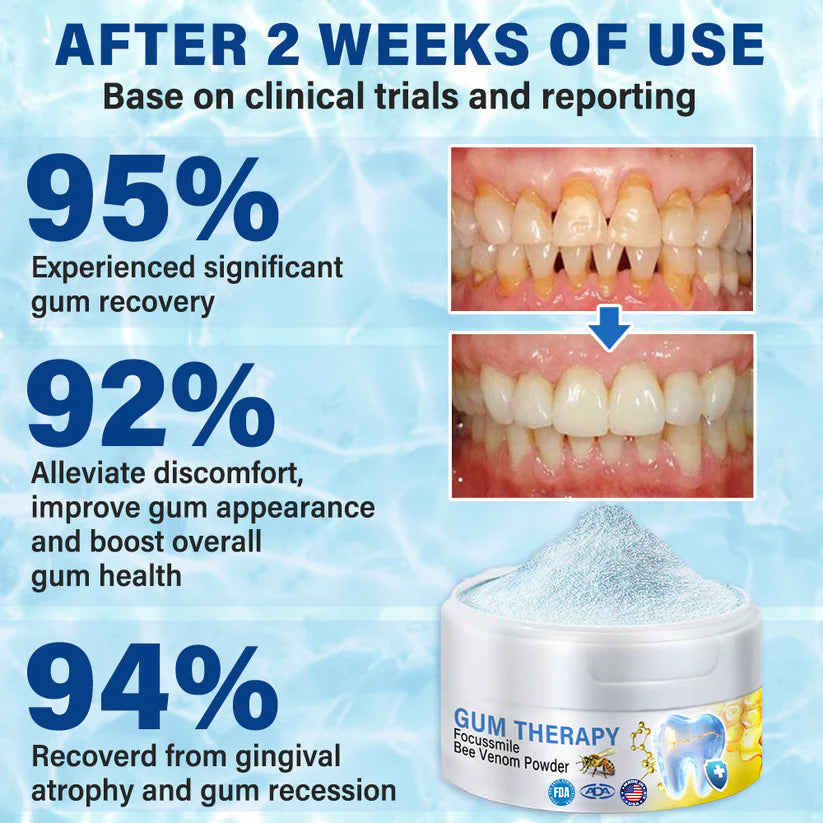 🏆Official Store |🧑🏽‍⚕️ODALIT™ Focussmile Bee Venom Treatment Oral Powder 🦷(ADA Recommended)