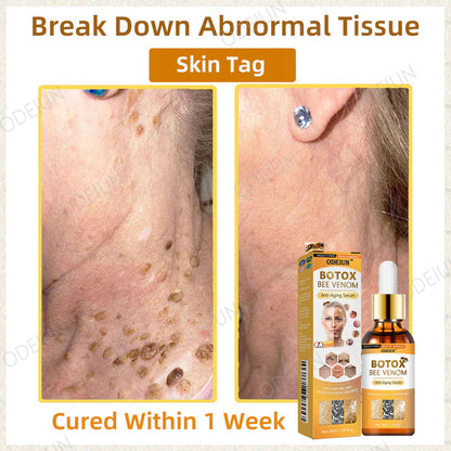 🎁Flash Sale - ODEIUN™ BOTOX Bee Venom Anti-Aging Serum - Suitable for all skin types🐝💎