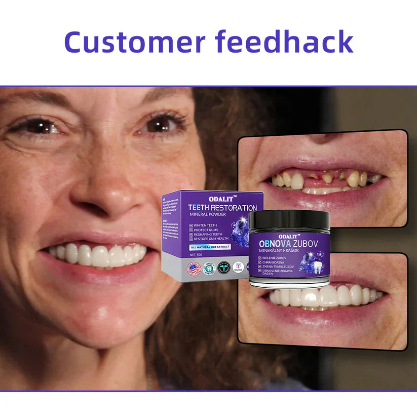🎁Flash Sale - Don’t Miss Out - ODALIT™ Teeth Restoration Mineral Powder🦷👩‍⚕️(ADA recommended)