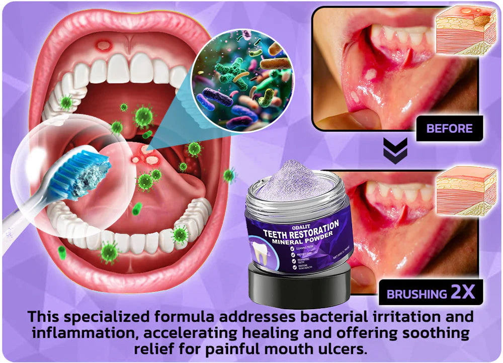 🌿Flash Sale - Don’t Miss Out - ODALIT™ Teeth Restoration Mineral Powder🦷(ADA recommended)👩‍⚕️(Treats periodontitis and mouth ulcers, prevents tooth loss, and repairs gum recession)
